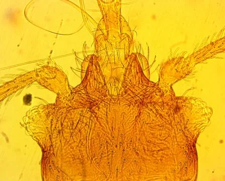 Common bed bug (Cimex lectularius) head - permanent slide plate under high ma Stock Photos