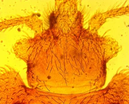 Common bed bug (Cimex lectularius) head - permanent slide plate under high ma Foto stock