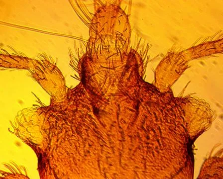 Common bed bug (Cimex lectularius) head - permanent slide plate under high ma Stock Photos