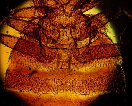 Common bed bug (Cimex lectularius) underside - permanent slide plate under hi Stock Photos