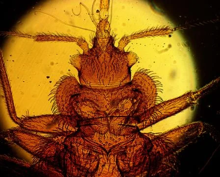 Common bed bug (Cimex lectularius) underside - permanent slide plate under hi Stock Photos