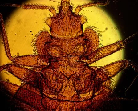Common bed bug (Cimex lectularius) underside - permanent slide plate under hi Fotos de archivo