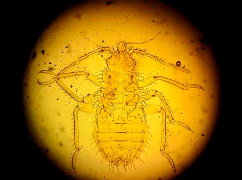 Common bed bug (Cimex lectularius) first nymph - permanent slide plate under Stock Photos