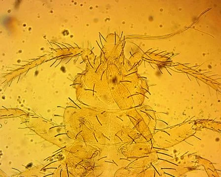 Common bed bug (Cimex lectularius) first nymph - permanent slide plate under Stock Photos