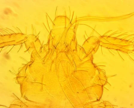 Common bed bug (Cimex lectularius) first nymph - permanent slide plate under Stock Photos