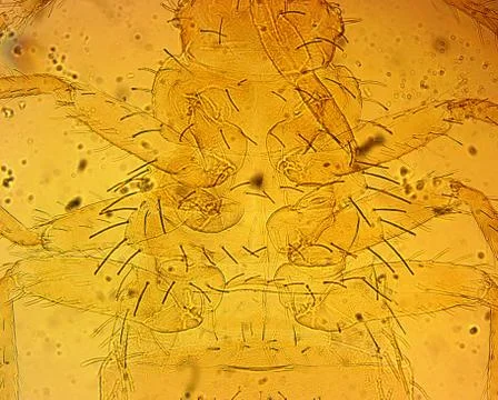 Common bed bug (Cimex lectularius) first nymph - permanent slide plate under Foto stock