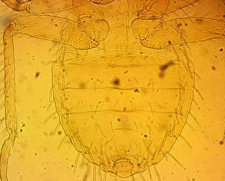 Common bed bug (Cimex lectularius) first nymph - permanent slide plate under Stock Photos