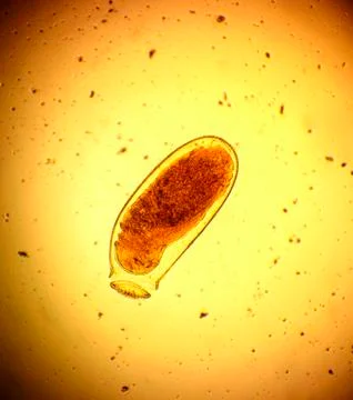 Common bed bug (Cimex lectularius) egg - permanent slide plate under high m.. Stock Photos