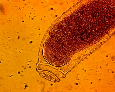 Common bed bug (Cimex lectularius) egg - permanent slide plate under high m.. Stock Photos