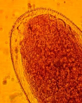 Common bed bug (Cimex lectularius) egg - permanent slide plate under high m.. Stock Photos