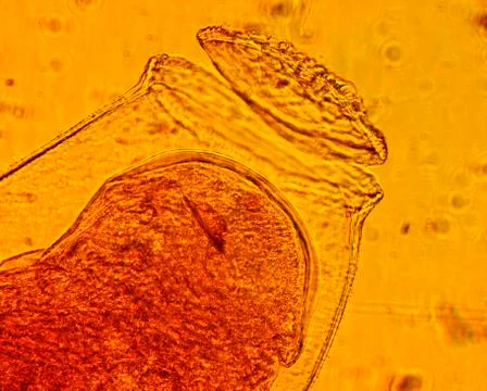 Common bed bug (Cimex lectularius) egg - permanent slide plate under high m.. Foto stock