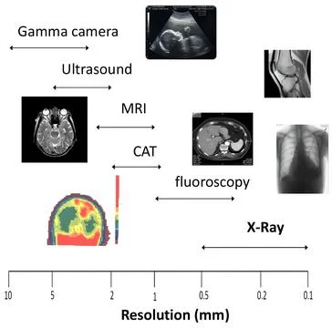 Comparative Imaging Modalities Chart with Gamma Camera, Ultrasound, MRI, CA.. Stock-Fotos