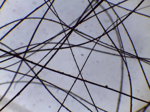 Comparative microscopy reveals the fine, dark, and linear structure of mamm.. 스톡 사진