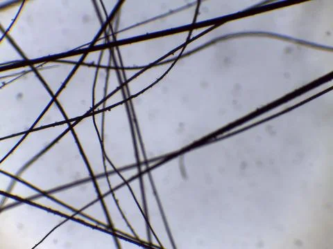 Comparative microscopy reveals the fine, dark, and linear structure of mamm.. Stock Photos
