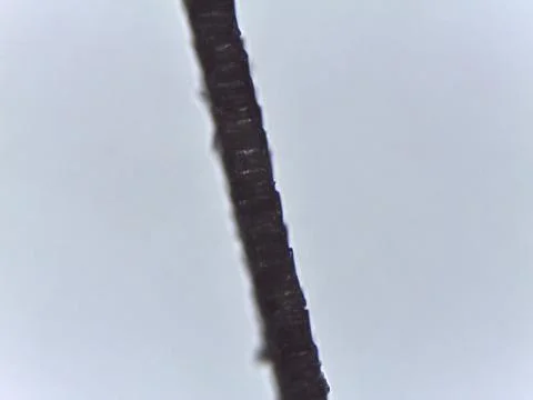Comparative microscopy reveals the fine, dark, and linear structure of mamm.. Stock Photos