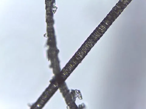 Comparative microscopy reveals the fine, dark, and linear structure of mamm.. Foto stock