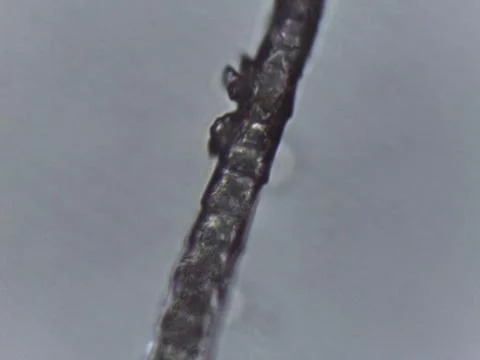 Comparative microscopy reveals the fine, dark, and linear structure of mamm.. Stock Photos