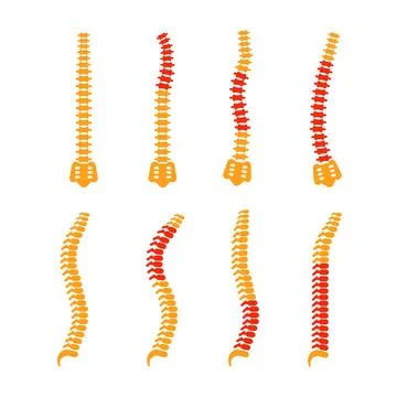 Comparing different human spine shapes with correct and incorrect posture Stock Illustration