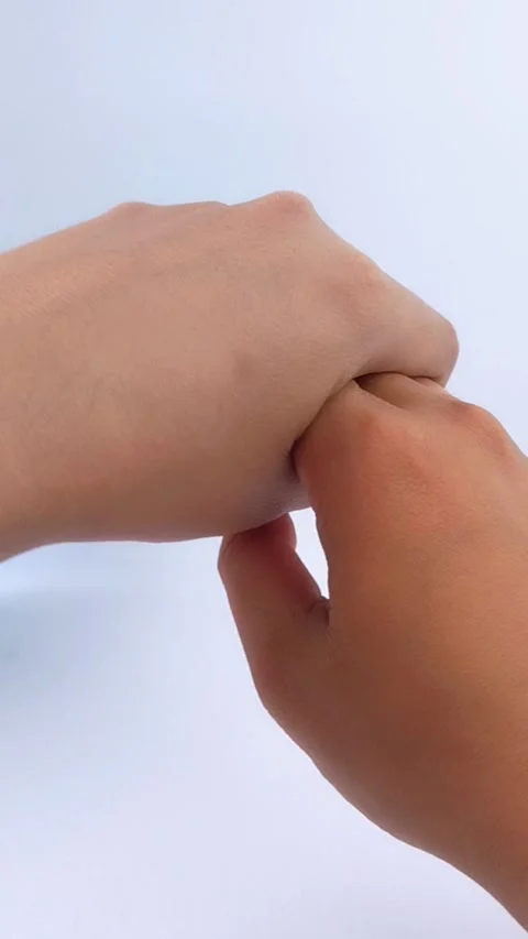 Comparing skin color of both hands after using whitening cream. Vídeos de archivo 335388811