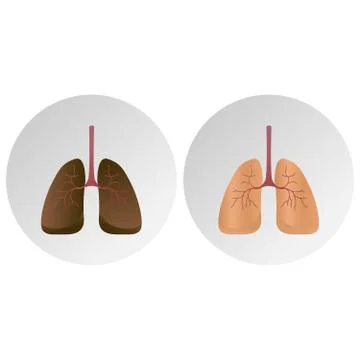 Comparison between healthy lung and cancer lung isolated on white background Illustrazione stock