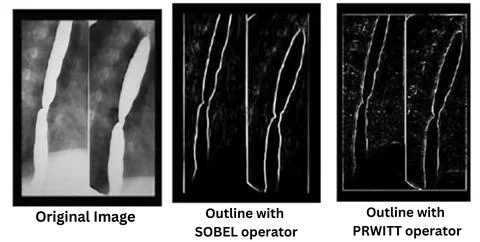 Comparison of Edge Detection Techniques Using Sobel and Prewitt Operators o.. Stock Photos