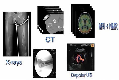 Comparison of Imaging Techniques: X-rays, CT, MRI/NMR, and Doppler Ultrasou.. Stock-Fotos