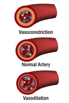 Comparison of normal, vasoconstriction and vasodilation blood vessels with .. Stock Illustration