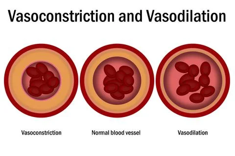 Comparison of normal, vasoconstriction and vasodilation blood vessels with .. Stock Illustration