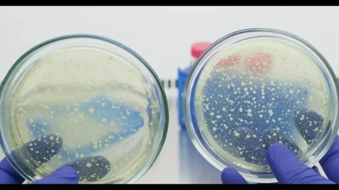 Comparison of two Petri dishes Stock Footage 308243066