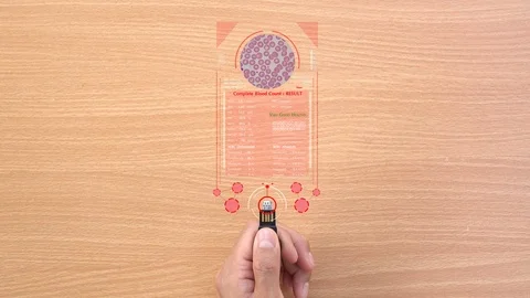 Complete blood count testing your self at home.No sharp injury from needle. Futu Stock Footage 101125829