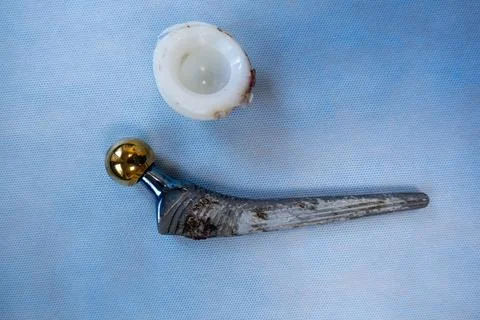 A complete explanted hip prosthesis lies on a blue surgical drape Stock Photos