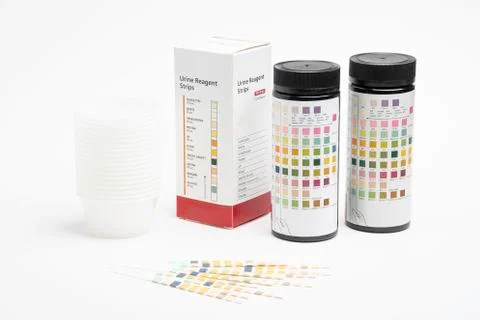 A Complete Set Of Urine Reagent Test Kit Foto stock