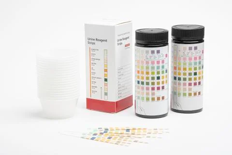 A Complete Set Of Urine Reagent Test Kit Stock Photos