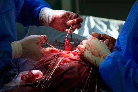 Complex operation Stockfoto's