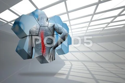 Composite image of back injury diagram on abstract screen Stock Illustration