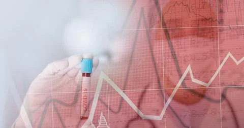 Composition of medical data processing over in face mask and covid 19 tube blood Foto stock