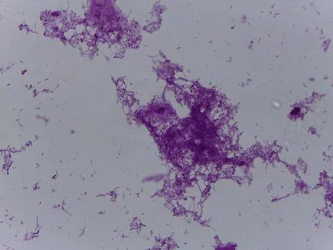 Comprehensive Microscopic Study of Mixed Bacterial Types and Primitive Vert.. 스톡 사진