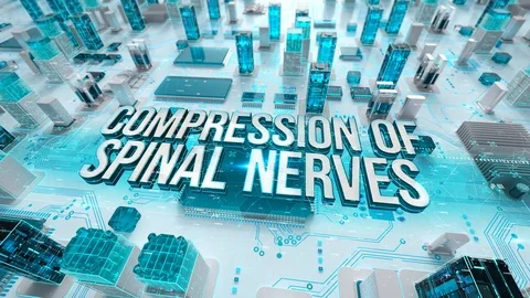 Compression of Spinal Nerves with medical digital technology concept 스톡 동영상 106543718