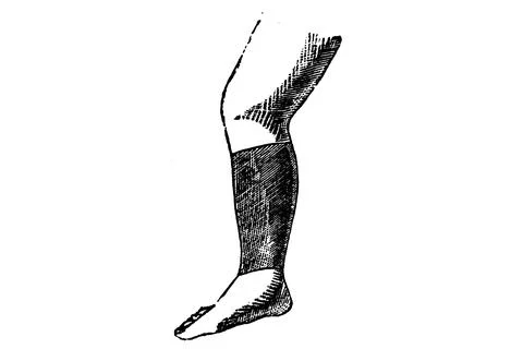 Compression Stocking – 1897 Original Vintage Engraved Illustration Stock Illustration
