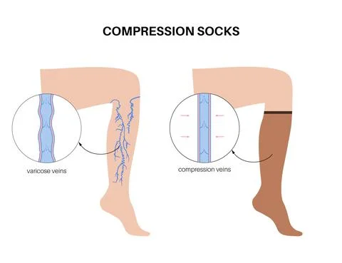 Compression stocking pressure Stock Illustration