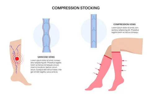 Compression stocking pressure Illustrazione stock