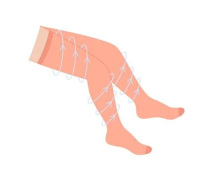 Compression stocking, socks on leg with arrows. Treatment varicose veins on f Stock Illustration