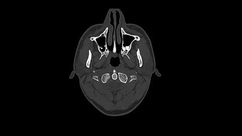 Computed medical tomography MRI scan of healthy male head Stock-Footage 98338993