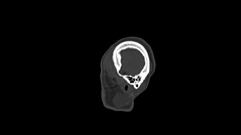 Computed medical tomography MRI scan of healthy male head 库存影片 98339558