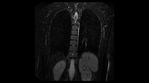 Computed Medical Tomography MRI Upscaled Scan of Healthy Young Female Torso Stock Footage 81464658