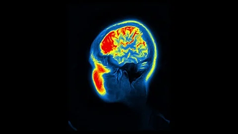 Computed Medical Tomography MRI Upscaled Scan of Healthy Young Female Head Stock Footage 82637563