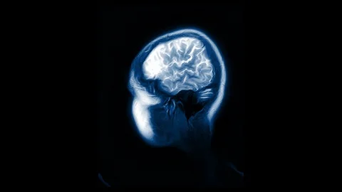 Computed Medical Tomography MRI Upscaled Scan of Healthy Young Female Head Stock Footage 88231894