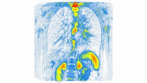 Computed Medical Tomography MRI Upscaled Scan of Healthy Young Female Torso Stock Footage 89308652