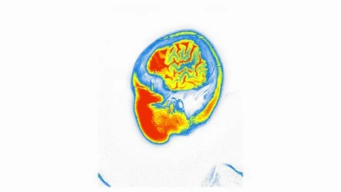 Computed Medical Tomography MRI Upscaled Scan of Healthy Young Female Head Stock Footage 101564127