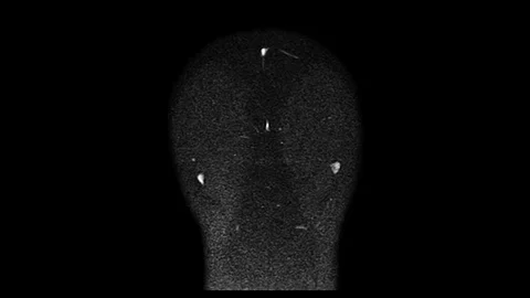 Computed Medical Tomography MRI Upscaled Scan of Healthy Young Female Head Stock Footage 104645236